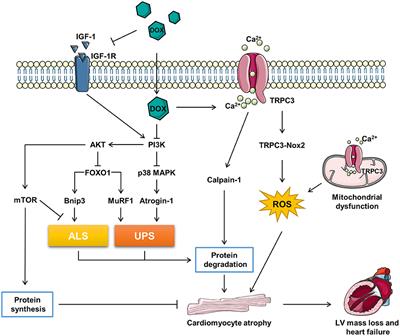 Cardiomyocyte Atrophy, an Underestimated Contributor in Doxorubicin-Induced Cardiotoxicity